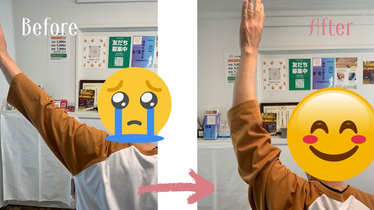 施術前後の比較 3